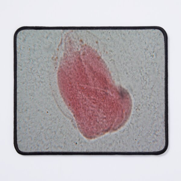 Item preview, Rhizopus  designed and sold by CellsOfWorld.