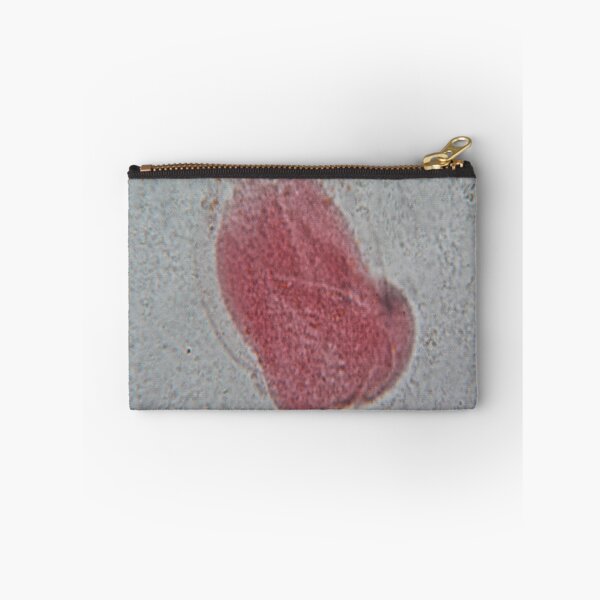Item preview, Rhizopus  designed and sold by CellsOfWorld.