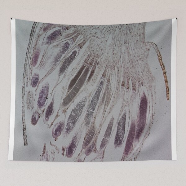 Item preview, Moss Anteridia  designed and sold by CellsOfWorld.