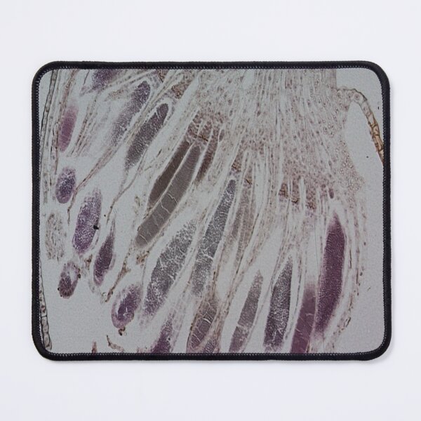 Item preview, Moss Anteridia  designed and sold by CellsOfWorld.