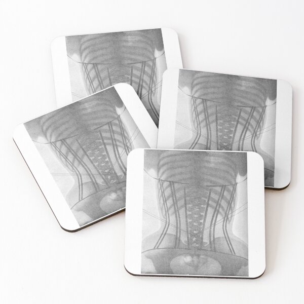 Aperçu de l'œuvre Les radiographies du corset du Dr Ludovic O'Followell créée et vendue par SewnMemories.
