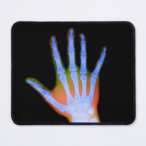 Item preview, X-Ray of a Hand designed and sold by ScienceSource.
