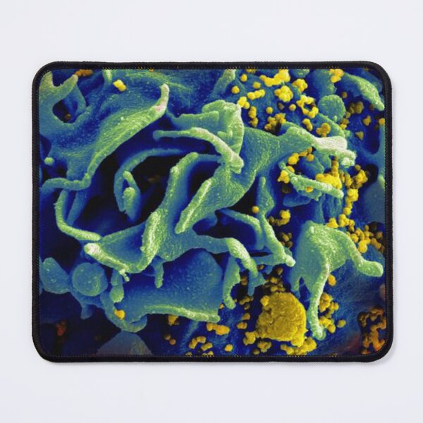 Item preview, HIV-infected T Cell, SEM designed and sold by ScienceSource.