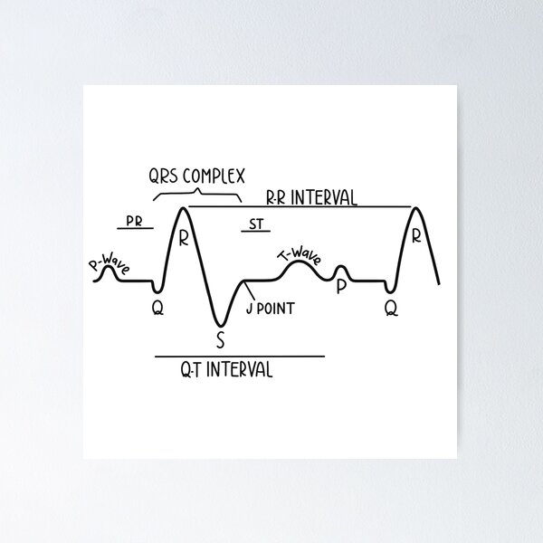 Item preview, Hand Drawn Normal Electrocardiogram ECG Black designed and sold by SofiaSava01.
