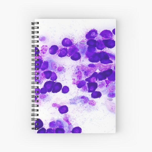 Artikel-Vorschau von Mastzelltumor (MCT), designt und verkauft von Cytologyart.