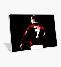 The King Laptop Skin