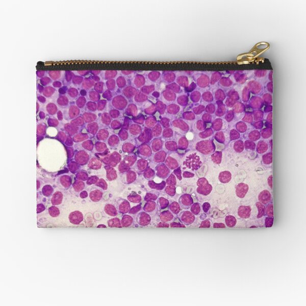 Item preview, Lymphoma mitosis designed and sold by Cytologyart.