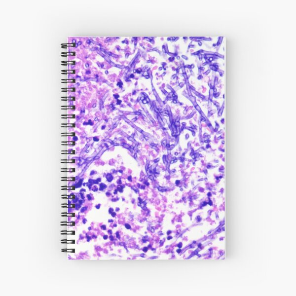 Item preview, Fungal rhinitis dog designed and sold by Cytologyart.