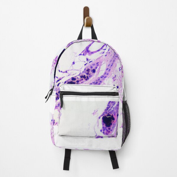 Item preview, Black hair follicular dysplasia designed and sold by Cytologyart.