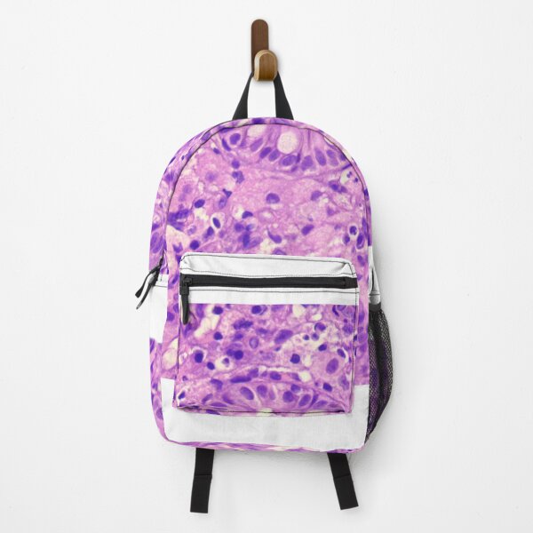Item preview, Histiocytic colitis designed and sold by Cytologyart.