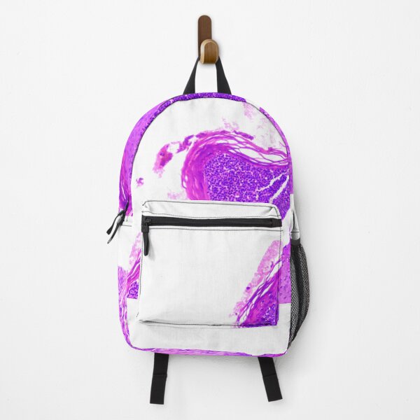 Item preview, Pustule pemphigus foliaceous designed and sold by Cytologyart.