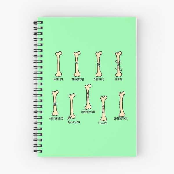 Aperçu de l'œuvre Types de fractures dessinées à la main créée et vendue par SofiaSava01.