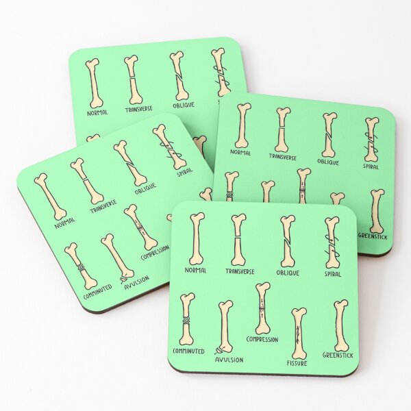 Item preview, Hand Drawn Types of Fractures designed and sold by SofiaSava01.
