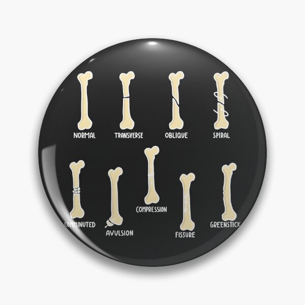 Item preview, Hand Drawn Types of Fractures White designed and sold by SofiaSava01.
