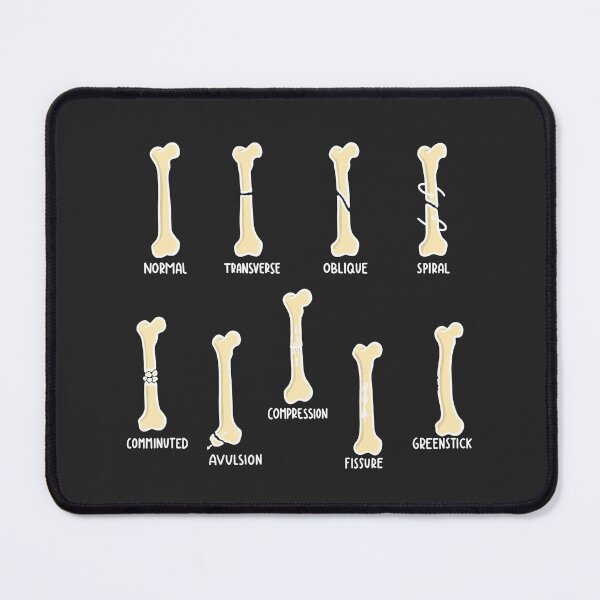 Item preview, Hand Drawn Types of Fractures White designed and sold by SofiaSava01.