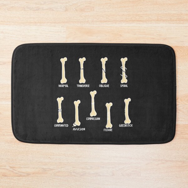Item preview, Hand Drawn Types of Fractures White designed and sold by SofiaSava01.
