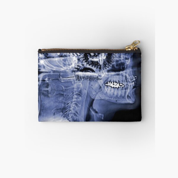 Item preview, My latest Xray designed and sold by Kevin Moore.