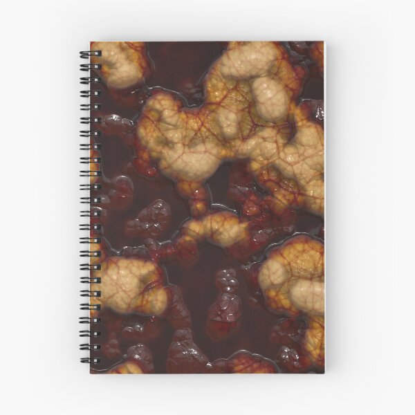 Item preview, Putrid Patterns - It’s Not A Tumour designed and sold by James-Cole.