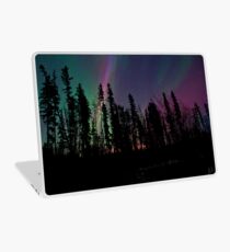 Backyard Auroras Laptop Skin