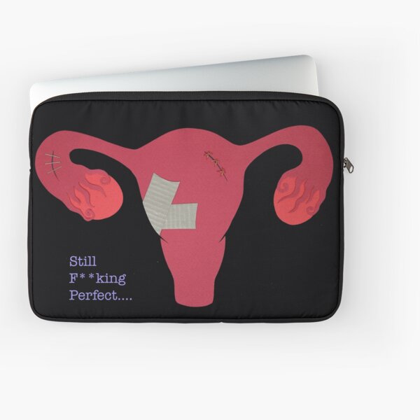 Laptop Sleeve