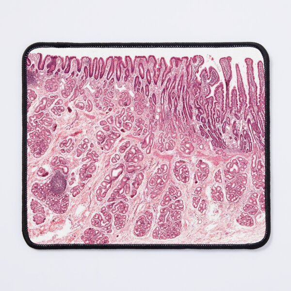 Item preview, Gastroduodenal Junction designed and sold by Love Histology.