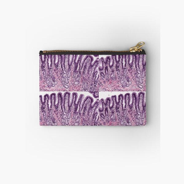Aperçu de l'œuvre Estomac pylorique créée et vendue par Love Histology.