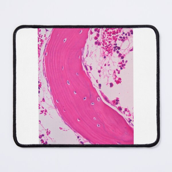 Item preview, Spongy bone designed and sold by Love Histology.