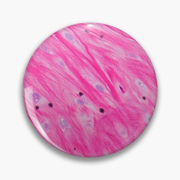 Item preview, Sharpey's fibres in bone designed and sold by Love Histology.