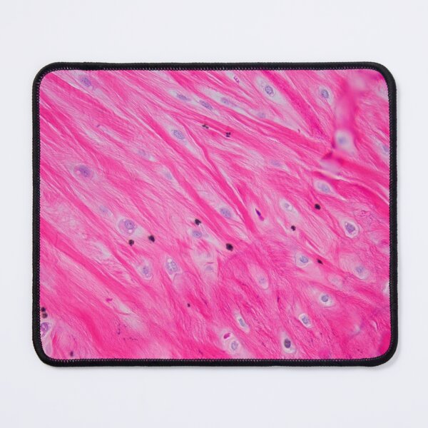 Item preview, Sharpey's fibres in bone designed and sold by Love Histology.
