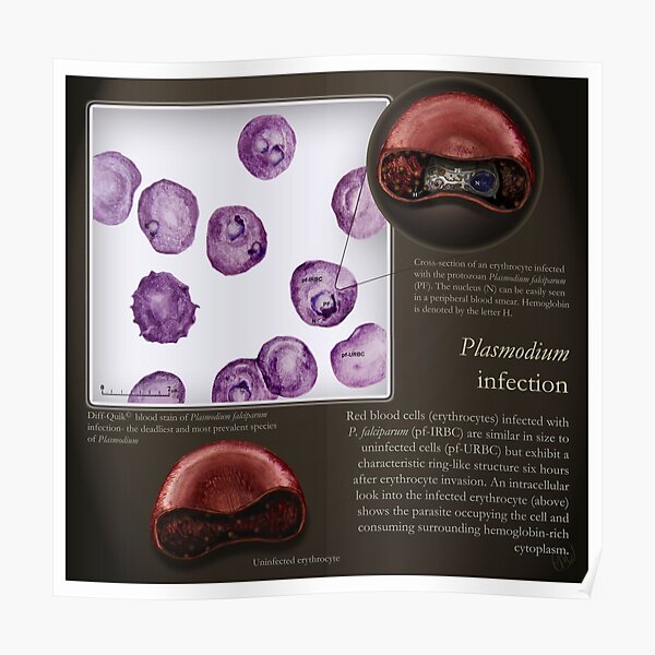 Plasmodium falciparum Poster