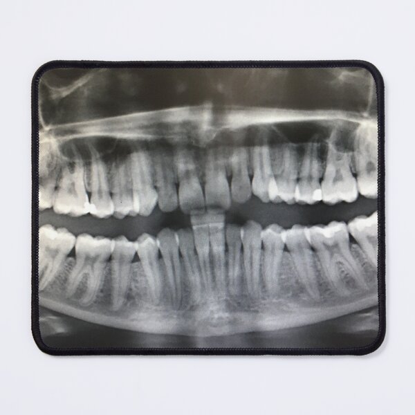 Item preview, Dental xray designed and sold by Budibabe.