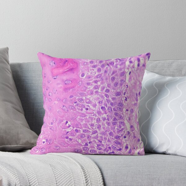 Item preview, espongiose 400x designed and sold by Cytologyart.