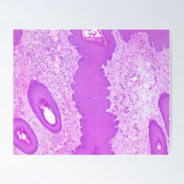 Item preview, festonado 100x designed and sold by Cytologyart.