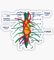Hemangioblastoma on the Wall Sticker