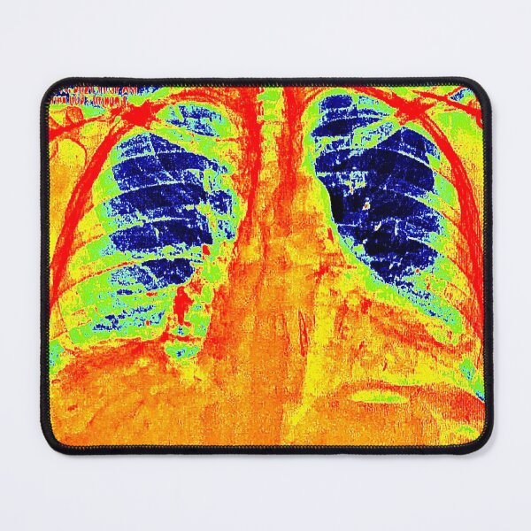 Item preview,  XRAY  designed and sold by paulvolker.