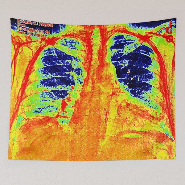 Item preview,  XRAY  designed and sold by paulvolker.