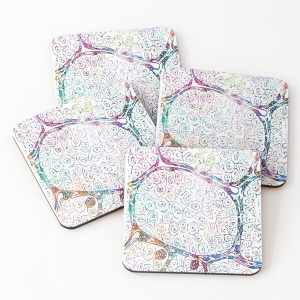 Item preview, Alveolar Soft Part Sarcoma Tissue Section designed and sold by EvasDreams.