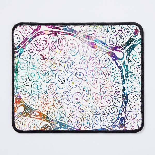 Item preview, Alveolar Soft Part Sarcoma Tissue Section designed and sold by EvasDreams.