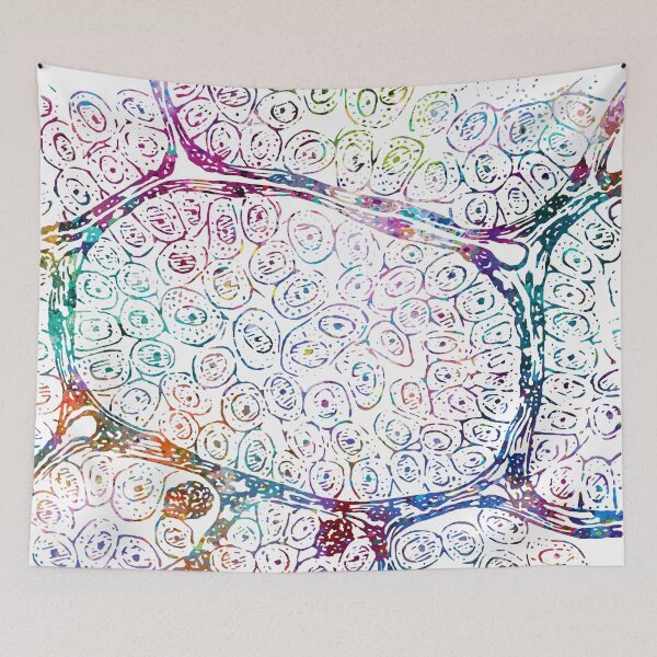 Item preview, Alveolar Soft Part Sarcoma Tissue Section designed and sold by EvasDreams.