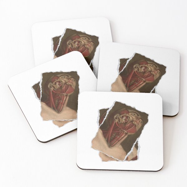 Item preview, Anatomical board Scratched face - Anatomical designs, human body and anatomy boards designed and sold by AdvanceDesign.