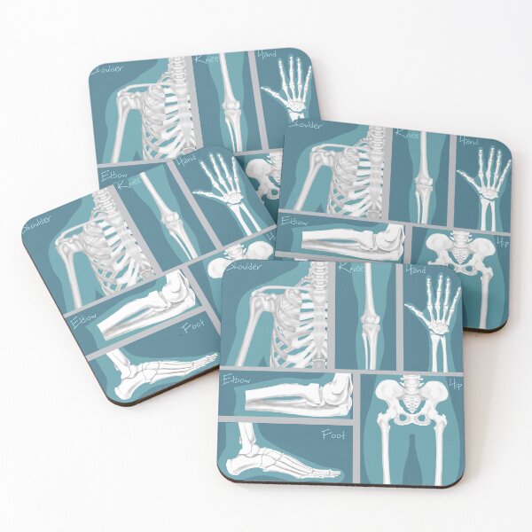 Item preview, Have a Joint! Shoulder, Foot, Knee, Hand and Hip designed and sold by BlueTreePublish.