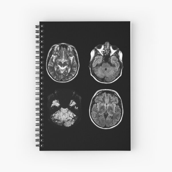 Item preview, Brain MRI x-ray designed and sold by gmstockstudio.