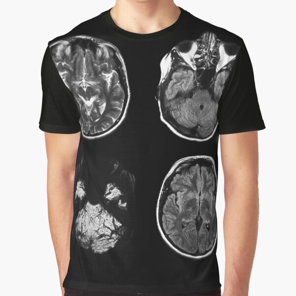 Item preview, Brain MRI x-ray designed and sold by gmstockstudio.