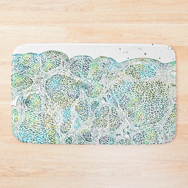 Item preview, Liver Histology Atrophic Cirrhosis Anatomy designed and sold by EvasDreams.