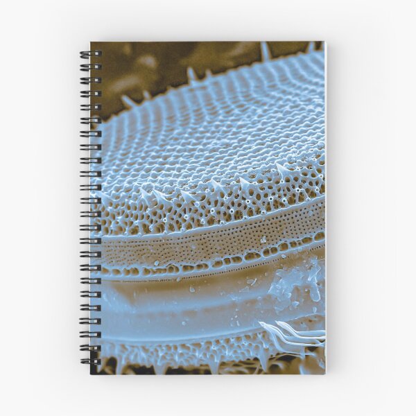 Item preview, Diatom - Thalassiosira (SEM) designed and sold by DiatomsATTACK.