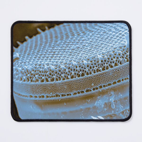 Item preview, Diatom - Thalassiosira (SEM) designed and sold by DiatomsATTACK.