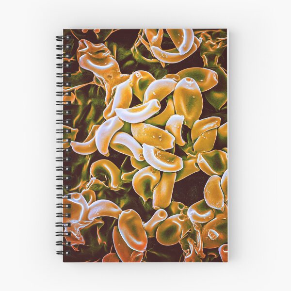 Item preview, Mushroom Spores in the SEM (Orange) designed and sold by DiatomsATTACK.