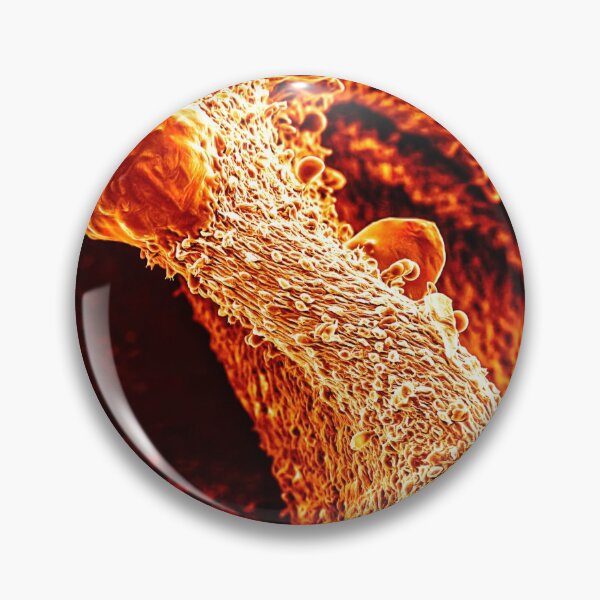 Item preview, Mushroom in SEM (orange) designed and sold by DiatomsATTACK.