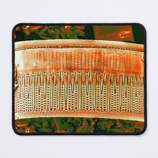 Item preview, Diatom - Aulacoseira (Fire Red) designed and sold by DiatomsATTACK.