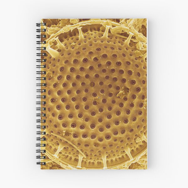 Item preview, Diatom - Thalassiosira (external, gold) designed and sold by DiatomsATTACK.